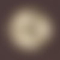 Penicillium camembertii. Anzucht auf unselektivem Kimmig-Agar. Sehr schnell wachsende, flache, we...