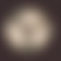 Penicillium spp.. Kulturoberseite: Anzucht auf unselektivem Kimmig-Agar. Sehr schnell wachsende K...