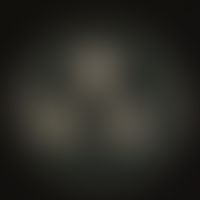 Candida guilliermondii. Anzucht auf selektivem, modifiziertem (Cycloheximid, Chloramphenicol) Kim...