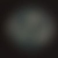 Candida guilliermondii. Kulturunterseite: weiß bis cremefarben.
