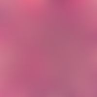 Kimura, morbus. diffuse infiltrate from T- and B-lymphocytes as well as numerous eosinophils. inc...