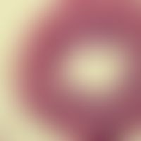 Adiaspiromykosis; detail enlargement of the sphaerules of Emmonsia crescens; lung; HE staining (P...