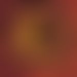 Adiaspiromykose. Sphaerulen von Emmonsia crescens; Lunge; Fungiqual A u. B Fluoreszenzfärbung (Pr...