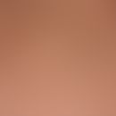 Alopecia arata Haare, kadaversierte bei Alopecie areata Fast, Marie 12.11. 14  SCF2162 DSCF2184 -...