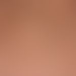 Alopecia arata Haare, kadaversierte bei Alopecie areata Fast, Marie 12.11. 14  SCF2162 DSCF2184 -...
