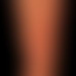 Virusexantheme:&nbsp;akutes papulo-veskulöses Exanthem verbunden mit leichten katharrhalischen Er...