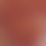 Incidentlight microscopy, angiectatic basic pattern Incident light microscopy: Angiectatic basic ...