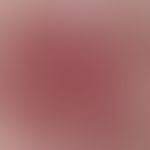 Incidentlight microscopy, angiectatic basic pattern. incident light microscopy: Angiectatic basic...