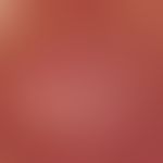 Reflected light microscopy: Area ofuniformly arranged puncttiform or polymorphic capillaries Refl...