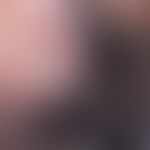 Reflected light microscopy, area of uniformly arranged puncttiform or polymorphic capillaries. Re...
