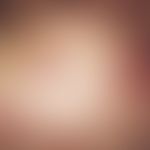 Immundefekt, variabler, primärer. Nekrotisierende Wundheilungsstörung nach Varizelleninfektion be...