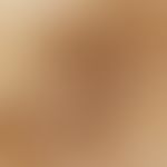 Reflected light microscopy, melanophages pseudotrabekel or diffusely distributed melanophages tra...