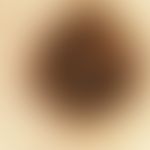 Reflectedlight microscopy, radial streaming Reflected light microscopy: Radial streaming in the p...