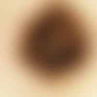 Reflectedlight microscopy, radial streaming Reflected light microscopy: Radial streaming in the p...