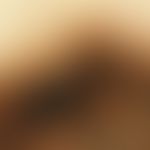 Reflected light microscopy, radial streaming Reflected light microscopy (detail magnification): R...