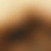 Reflected light microscopy, radial streaming Reflected light microscopy (detail magnification): R...