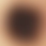 Incidentlight microscopy, radial streaming Incident light microscopy: Radial streaming in a junct...