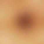 Reflectedlight microscopy: zonally superimposed stains of different shades without internal struc...