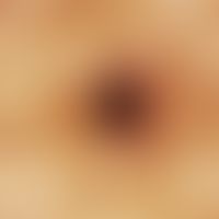 Reflectedlight microscopy: zonally superimposed stains of different shades without internal struc...
