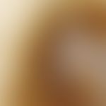 Auflichtmikroskopie, Melanophagenumsäumte Regressionszonen. Auflichtmikroskopie (Ausschnitt aus e...