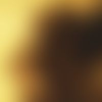 Auflichtmikroskopie, Pseudopodienartige Randzone. Auflichtmikroskopie (Ausschnitt aus einem unkla...
