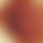 Incident light microscopy, inverse (negative) pigment network. incident light microscopy (5 mm no...