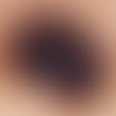 Auflichtmikroskopie, Brown/black dot vor blaugrauem Hintergrund. Auflichtmikroskopie (Ausschnitt ...