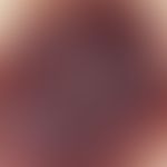 Reflected light microscopy, milky glassy bluish opaque areas with comedo-like keratin droplets. r...