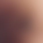 Reflected light microscopy, milky glassy bluish opaque areas with comedo-like keratin plugs. Deta...