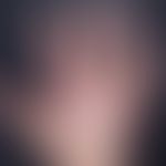 Gottron-Papeln. Rötlich-livide Papeln und Streifen über den Fingerknöcheln bei einem 16-jährigen ...