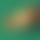 Anthrenus-Dermatitis. Von einer Patientin gesammelte Larve des gemeinen Teppichkäfers (Anthrenus ...