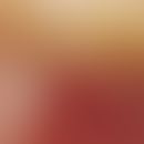 Auflichtmikroskopie, Basisarchitektur aus polymorphen und/oder aneurysmatischen Gefäßen. Auflicht...