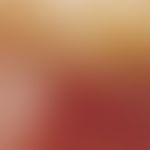 Reflected light microscopy, basic architecture of polymorphic and/or aneurysmatic vessels. reflec...