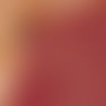Reflected light microscopy, basic architecture of polymorphic and/or aneurysmatic vessels. reflec...