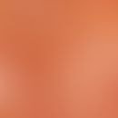 Reflected light microscopy, perivasal melanophages. reflected light microscopy: section of a lent...