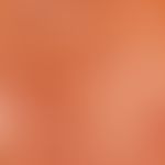 Reflected light microscopy, perivasal melanophages. reflected light microscopy: section of a lent...