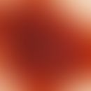 Incident light microscopy, tumour-edged pigment network breaks. Incident light microscopy: 5.5 mm...