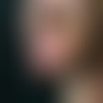 Lymphedema, secondary bulging of the foreskin and possibly of the penis shaft; no signs of inflam...