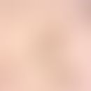 Fascioliasis. egg from Fasciola hepatica. typically the operculum (lid) is found, partly already ...