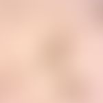 Fascioliasis. egg from Fasciola hepatica. typically the operculum (lid) is found, partly already ...