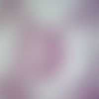 Fascioliasis. Querschnitt durch Fasciola hepatica. Die weit verzweigten Darmanteile sind in der M...