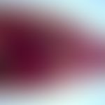 Dicrocoeliasis. Dicrocoelium dendriticum: adulter Wurm. Im vorderen Abschnitt sind (rechts) der M...