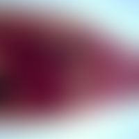 Dicrocoeliasis. Dicrocoelium dendriticum: adulter Wurm. Im vorderen Abschnitt sind (rechts) der M...