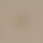 Clonorchiasis. egg of Clonorchis sinensis, yellow-brown, with a size of 20-30 x 15 µm. one pole s...