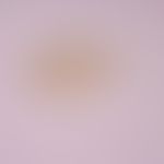 Clonorchiasis. Clonorchis sinensis egg.