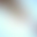 Opisthorchiasis. adult worm of Opisthorchis felineus. In the anterior section the mouth suction c...