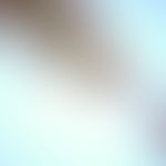 Opisthorchiasis. Adulter Wurm von Opisthorchis felineus. Im vorderen Abschnitt sind Mundsaugnapf ...