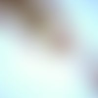 Opisthorchiasis. Adulter Wurm von Opisthorchis felineus. Im vorderen Abschnitt sind Mundsaugnapf ...