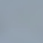Cyclosporiasis: Oocyst of Cyclospora cayetanensis; microscopic detection after acid-proof Kinyoun...