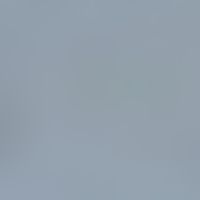 Cyclosporiasis: Oocyst of Cyclospora cayetanensis; microscopic detection after acid-proof Kinyoun...
